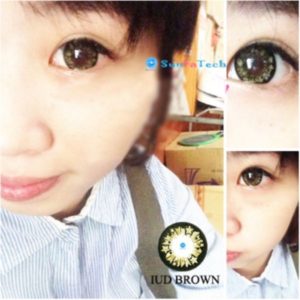 kinh gian trong mau nau IUD Brown